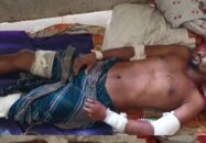 মোল্লাহাটে যুবককে অপহরণ করে কুপিয়ে জখম, আশঙ্কাজনক অবস্থায় হাসপাতালে