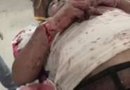 বন্দরে গার্মেন্টস কর্মকর্তা কে কুপিয়ে জখম