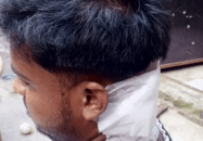 বন্দরে কলেজ ছাত্রী কে উত্ত্যক্ত করার প্রতিবাদ করায় বাবা ও ভাইকে কুপিয়ে জখম